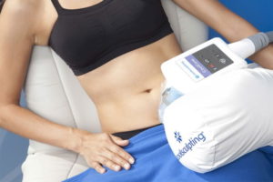 How Does Coolsculpting Work